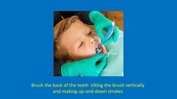 staff member brushing the back of the teeth, tilting the brush vertically and making up-and-down strokes