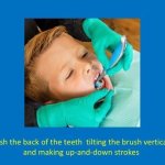 staff member brushing the back of the teeth, tilting the brush vertically and making up-and-down strokes