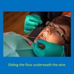 staff member sliding floss underneath a patient's braces wire