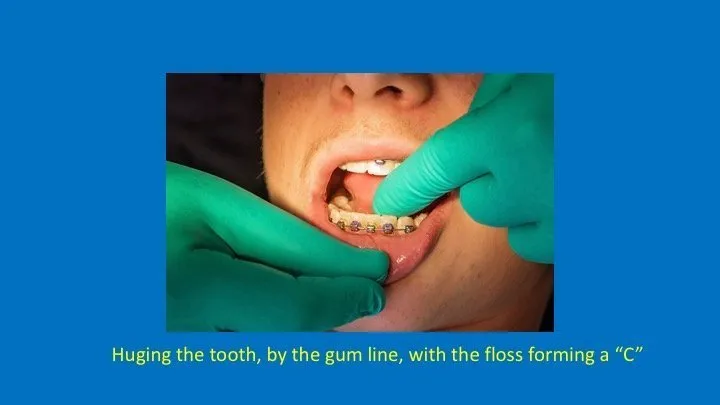 staff member hugging the tooth, by the gum line, with the floss forming a 'C'