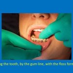 staff member hugging the tooth, by the gum line, with the floss forming a 'C'