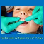 staff member hugging the tooth, by the gum line, in a 'C' shape