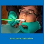 staff member brushing above the brackets